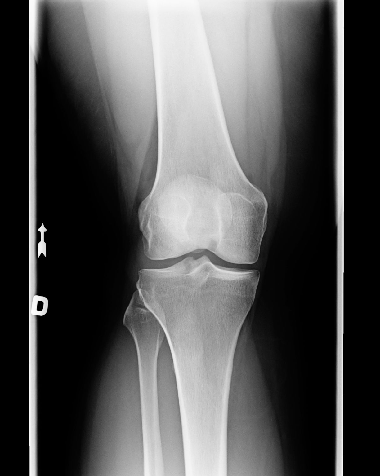 Kniescheibe Orthop De Wien Dr Martin Gruber